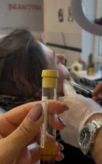 بوتاکس مصپورت