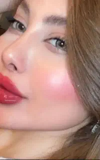عروسک شو با خدمات تخصصی نصف قیمت ژل وبوتاکس