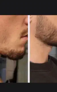منافض پوست صورتت بستست ، به خاطر همین ریش نداری