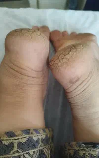 کلینیک ماساژ وماساژ درمانی حس آرامش