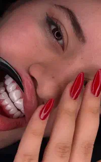 هر فک کامپوزیت ۱۶ میلیون