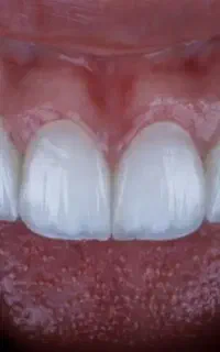 دندانسازی تخصصی،۲۰سال سابقه،دندان مصنوعی ودست‌کامل