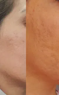 سلام اقای دیهول هستم مشاور تخصصی سلامت عمومی بدن
