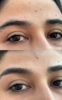 مدل اصلاح تخصصی قرینه سازی ابرو