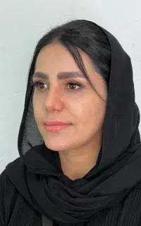 رینوپلاستی(جراحی بینی)۱۷/۵توسط متخصص گوش وحلق بینی