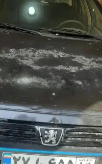 رفع آفتاب سوختگی دائمی