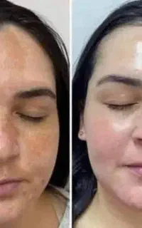 صابون سفید کننده نمایندگی اصل چابهار