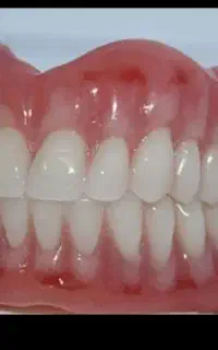 آموزش دندانسازی دیجیتال