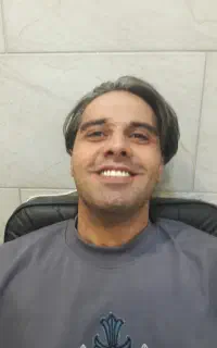 ساخت دندان مصنوعی ،تعمیر دندان مصنوعی،
