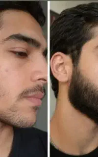 این ریش داره و تو نداری