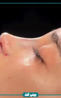 جشنواره تخفیفات بینی لند