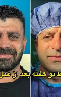 عمل بینی  عمل دماغ شمال