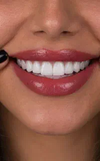 جشنواره تخفیف دندانپزشکی در کرمانشاه(تعرفه دولتی