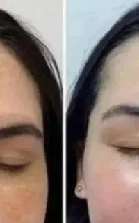 پاک کننده کک  مگ