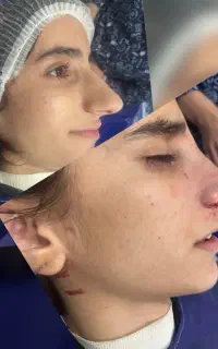 عمل بینی ساکشن کاشت مو غبغب ژل بوتاکس