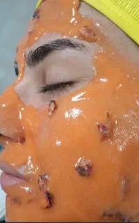 فشیال تخصصی پوست با تخفیف ویژه