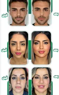 ژل و بوتاکس و مزوژل مزو تراپی مدل با *تخفیف ویژه*