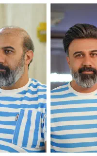 بزرگ ترین مرکز پروتز مو و تعمیر ضمانت داردراصفهان