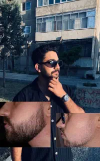 پوست و مو