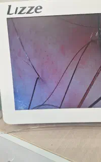 پاکسازی عمیق کف سر