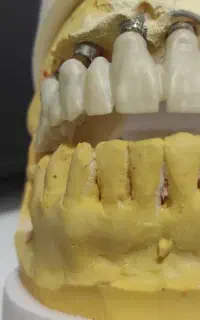 لابراتوار دندانسازی