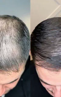 یک شروع تازه برای موهات