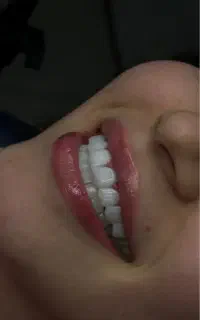 تخفیفات پایانی تابستان کامپوزیت