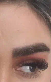 کاشت مو ابرو