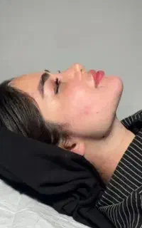 ساکشن غبغب با اقساط