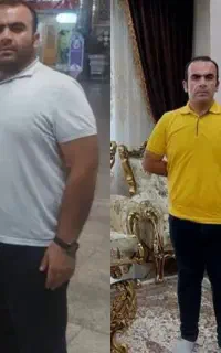 لاغری تضمینی ریشه یابی علت اضافه وزن