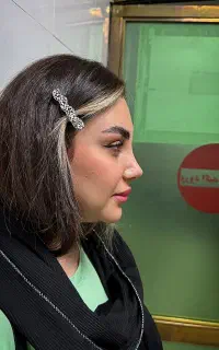 عمل بینی در تهران/برای شهروندان اندیمشک/50میلیون