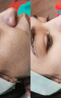 فشیال تخصصی