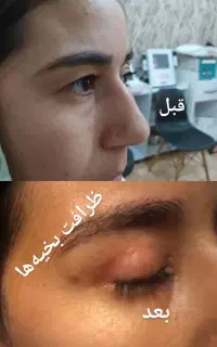 بلفاروپلاستی/مامو پلاستی/ابدومینوپلاستی/لیپوساکشن