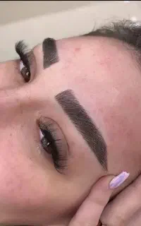 فیبروز و میکروبلیدینگ تخصصی ابرو (بن مژه رایگان)