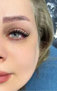 خدمات کاشت هیدن و لیفت ابرو در بلوار دیلمان