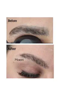 ریمو ابرو و تتو و فیشال تخصصی