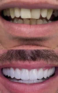 دندانپزشکی قسطی ویژه شهرکرد