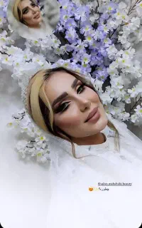 خدمات اریشی در منزل
