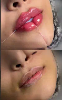 جشنواره تخفیف اموزش کامل ژل و بوتاکس به صورت تخصصی