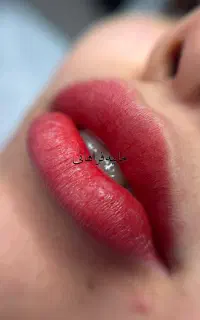 مرکز تخصصی شیدینگ لب رژ لب و درمان تیرگی لب
