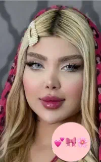 آف 50% تزریق چربی ژل لب چال لپ هیدن چال گونه