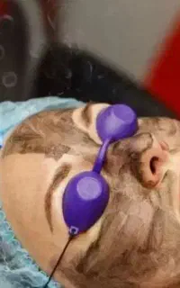 لیزر موهای زاید ریمو تتو لاغری پلاسما کربن تراپی