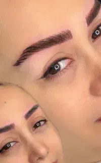 مدل برای فیبروز ابرو