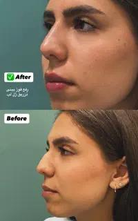 ژل ۸۰۰بوتاکس ۷۰۰ فول فیس ۵۸۰۰ لیفت صورت ۹۰۰