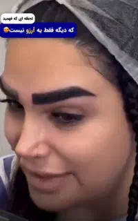 کاشت ابرو ،تزریق ژل وبوتاکس توسط پیراپزشک