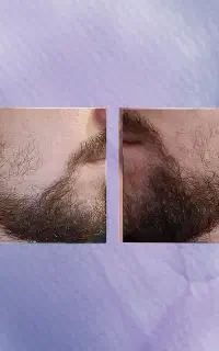 پر از مو میشه صورتت اگر از این استفاده کنی