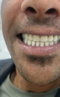 کلینیک دندانسازی ‌مروارید۴۰٪ افر ب مدت ۲۰ روز