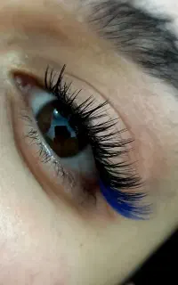 کاشت مژه هیدن فقط 350