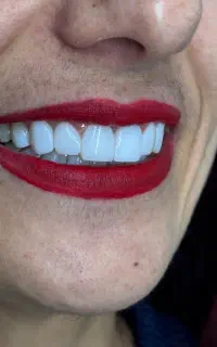 کامپوزیت با شرایط اقساط