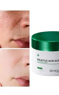 ماسک ضدآکنه سالیسیلیک اسید(ضدجوش و منافذ) فیشیال